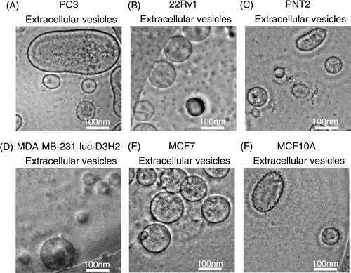 Fig. 1 Morphology of purified EVs from 6 cell lines, including cancer cells and non-cancer cells. Shown are representative phase-contrast transmission electron microscopy images of EVs from (A) PC3 cells, (B) 22Rv1 cells, (C) PNT2 cells, (D) MDA-MB-231-luc-D3H2LN cells, (E) MCF7 cells and (F) MCF10A cells. The EVs were purified from the culture supernatants of these cells using a conventional centrifugation method. The scale bar indicates 100 nm.
