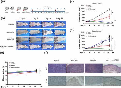 Figure 2. Synergistic antitumor effects of an anti-PD-L1 mAb and ALA-PDT in an implanted cSCC mouse model. (a) Diagram of the experimental design of ALA-PDT and an anti-PD-L1 mAb applied to the cSCC mouse model. (b) Representative tumor growth in each group. (c) Primary tumor growth curve of each group (n = 5 for each group); (d) distant tumor growth curve of each group (n = 5 for each group). (e) Mouse weight curve of each group. (f) Representative HE and Ki67 staining of distant tumors in each group. *p < 0.05, **p < 0.01; the scale bar is 200 μm.