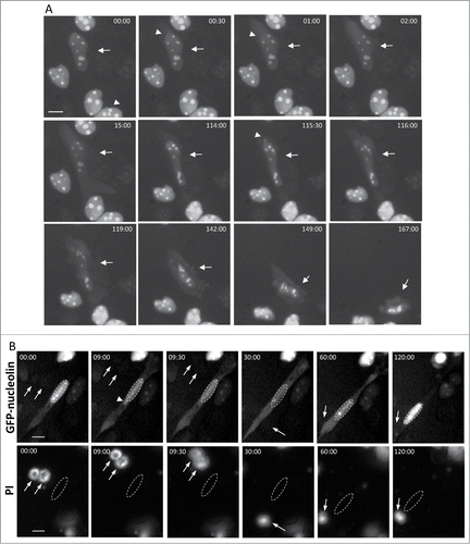 Figure 2. SIGRUNB preceded the appearance of typical late onset features of apoptosis (A) SIGRUNB occurs before the appearance of membrane blebbing and bubbling and nuclear condensation. The still images shown were taken from Vid. S2. Arrow indicates a cell undergoing SIGRUNB. Arrowhead points to a GFP-nucleolin-containing nuclear bubble. Indicated time points (min:s) are expressed as described in Figure 1. t = 00:00 corresponds to the image captured 50 min into the recording. (B) SIGRUNB occurs before loss of plasma-membrane integrity. PI was added to the culture medium 17 h after cisplatin treatment. The still images shown were taken from Vid. S3 and are from the same field visualized separately for detection of GFP-nucleolin (upper panel) and PI (lower panel). The images show a GFP-nucleolin-expressing cell which developed nuclear bubble (arrowhead) that burst shortly thereafter. No PI staining was observed in this cell at any of the time points shown. The position of the cell nucleus undergoing SIGRUNB is shown by dashed oval and is also superimposed on the PI images. Arrows indicate PI stained apoptotic nuclei of neighboring GFP-nucleolin-negative cells (the position of those cells is shown both in the PI panel and also when superimposed on the GFP-nucleolin images). Indicated time points (min:s) are expressed as describe in Figure 1. t = 00:00 corresponds to the image captured at the beginning of the recording. The images shown are from representative experiments from 8 and 3 independent experiments for A and B respectively. Bar = 10 μm.
