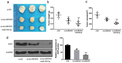 Figure 7. Silencing of circABCB10 inhibited NSCLC growth by modulating the miR-584-5p/E2F5 axis. (a) Representative images of subcutaneous tumors from three groups. (b, c) Tumor volume and tumor weight of nude mice. (d) Protein expression level of E2F5. Compared with si-circABCB10, #P < 0.05, ** p < 0.01, compared with p-NC, *** p < 0.001)