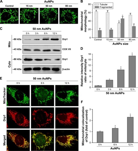 Figure 5 The size effect of AuNPs on mitochondrial morphology in NSCLC cells.Notes: (A) After treatment with 15, 50, and 80 nm AuNPs for the indicated time points, Calu-1 were stained with MitoTracker® Green and changes in mitochondrial morphology were observed under a CLSM. Representative CLSM images are presented. (B) Quantitative analysis of mitochondrial morphology was carried out using ImageJ software. At least 20 cells were analyzed per condition for each experiment. *P<0.05, compared to the untreated control. (C, D) Immunoblot analysis of Drp1 in mitochondrial and cytosolic fractions at different time points after treatment with 50 nm AuNPs. (E, F) Immunofluorescence analysis of mitochondrial recruitment of Drp1 at 6 and 12 h post-treatment with AuNPs. The yellow color in the merged images represents the degree of colocalization between Drp1 (red) and mito (green). Magnification ×400.Abbreviations: AuNPs, gold nanoparticles; CLSM, confocal laser scanning microscope; cyto, cytoplasm; Drp1, dynamin-related protein 1; mito, mitochondria; NSCLC, non-small-cell lung cancer; TRAIL, tumor necrosis factor-related apoptosis-inducing ligand.