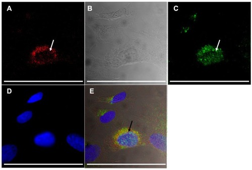 Figure 8 Uptake of A415-PCL by ATRA-treated SH-SY5Y TrkB+ cells after 8 hours of incubation, showing partial colocalization with the anti-early endosomal 1 antibody (arrows). Fluorescence of A415-PCL-labeled with TRITC (A), differential contrast image (B), immunocytochemistry of early endosomal autoantigene-1 (fluorescein isothiocyanate-labeled, (C), nuclear counterstaining (D), and merge of panels A–D (E).Note: Bar illustrates 100 μm.Abbreviations: ATRA, all-trans-retinoic acid; PCL, peptide-conjugated liposomes.