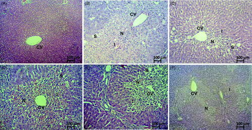 Figure 1. Microscopic analysis of liver section of normal and CCl4-induced hepatotoxic rats following pretreatment with 10% DMSO, NAC or MMCL. (A) Liver section of normal control animal exhibits normal hepatic cells each with well-defined cytoplasm, prominent nucleus and nucleolus and well brought central vein; (B) liver section of CCl4-induced hepatotoxic rats pretreated with 10% DMSO shows total loss of hepatic architecture with massive centrilobular hepatic necrosis, massive fatty changes vacuolization (steatosis), Kupffer cell hyperplasia and apoptosis; (C) liver section of CCl4-induced hepatotoxic rats pretreated with 50 mg/kg body weight of NAC demonstrates mild centrilobular hepatic necrosis, mark steatosis and mild haemorrhage; (D) liver section of CCl4-induced hepatotoxic rats pretreated with 50 mg/kg MMCL exhibits total loss of hepatic architecture with massive centrilobular hepatic necrosis, massive steatosis, kupffer cell hyperplasia, massive inflammation, massive haemorrhage and apoptosis; (E) liver section of CCl4-induced hepatotoxic rats pretreated with 250 mg/kg MMCL exhibits mark centrilobular hepatic necrosis, mild steatosis, marked inflammation, and mild haemorrhage; and (F) liver section of CCl4-induced hepatotoxic rats pretreated with 500 mg/kg MMCL shows normal liver architecture with mild centrilobular hepatic necrosis, mild inflammation (100× magnification). CV: central vein; N: necrosis; I: inflammation; S: steatosis.