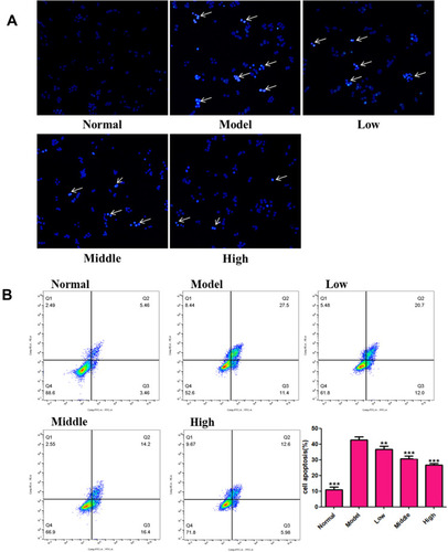 Figure 8 XYS (0.4, 0.8 and 1.6 mg/mL) protects against PC12 injury in vitro at 24 h. (A) DAPI staining; (B) flow cytometry. Data are the mean ± SD (n = 3). The white arrow indicates that the cell is showing a significant apoptotic signal (nuclear shrinkage). **P<0.01, ***P<0.001 vs the model group (OGD/R-induced PC12 cells without treatment with XYS).