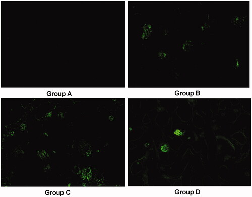 Figure 2. Representative confocal pictures of crystals in transparent renal sections (without HE staining) in groups A–D (100×).