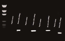 FIGURE 3  NFAT5 mRNA in the human and ovine placenta. Specific primers produced a 308bp PCR product for the human placenta and a 260bp product for the ovine placenta. mRNA from 293 FT cells was detected and used as positive control. For negative controls, cDNA was omitted from each reaction. A molecular weight standard ranging from 2,645 to 51 bp was used to identify the sizes of the PCR products.