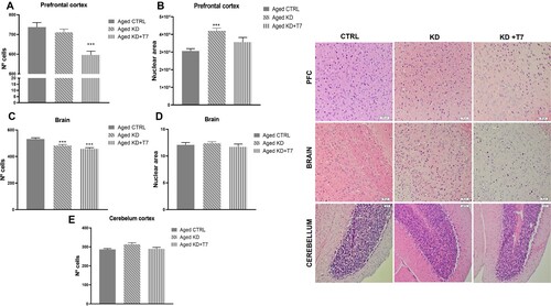 Figure 5. Cell and/or nuclear area counting of the prefrontal cortex (A and B), temporal lobe cortex (C and D), and cerebellum (E) slices. The counts were made in triplicate using Image J software. Bars represent the group mean and horizontal lines represent the standard error (n = 3 per group). ***p < 0.001. Representative slices H&E stained of each aged group (F). White rectangles represent 50 µm (H&E, ×20).