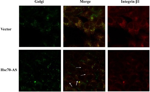 Figure 4 Reducing the expression of Hsc70 in U87 cells affected the subcellular localization of integrinβ1 subunit. After fixed and permeabilized, Vector/U87 cells (upper panel) or Hsc70-AS/U87 cells (lower panel) reacted with anti-integrin β1 mouse monoclonal antibody followed by incubation with rhodamine-conjugated goat anti-mouse IgG and C6-NBD (Golgi specific dye). Images were captured and analyzed with a Zeiss confocal microscope (40x).