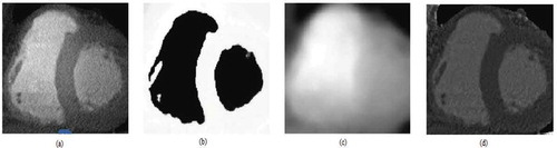 Figure 4. (a) Original CT scan image (b) Final segmented image (c) Bias field (d) Corrected image using the bias filed.