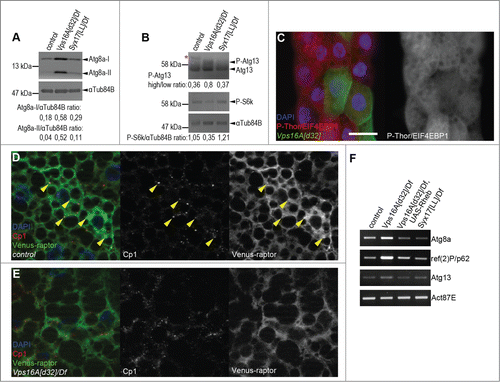 Figure 1. Reduced Tor activity in Vps16A mutants. (A) Representative western blots show that the levels of lipidated, autophagosome-associated Atg8a-II are much higher in well-fed Vps16A mutants than in control or Syx17-mutant L3-stage larvae. (B) The levels of P-S6k/Phospho-RPS6KB1 (Thr389) are reduced, while the ratio of hyperphosphorylated (slower migrating) to hypophosphorylated (faster migrating) Atg13 is increased in Vps16A mutants, compared to well-fed control or Syx17-mutant larvae. Asterisk marks a nonspecific band. (C) The level of P-Thor/Phospho-EIF4EBP1 (Thr37/46) is decreased in GFP-marked Vps16A-null mutant cells compared to neighboring control cells in mosaic fat bodies of well-fed larvae. (D) Venus-tagged raptor displays punctate localization in fat body cells of well-fed wild-type larvae, and colocalizes with Cp1 (Cathepsin L)-positive lysosomes (arrowheads). (E) Punctate localization of Venus-raptor is lost in Vps16A mutants. (F) RT-PCR analysis reveals the obvious transcriptional upregulation of Atg8a and ref(2)P/p62 in Vps16A mutants when compared to control or Syx17-mutant animals. Overexpression of Rheb in Vps16A mutants restores Atg8a and ref(2)P/p62 mRNA levels to those seen in control animals. Scale bar equals 20 µm for panels (C-E). Numbers represent protein level ratios estimated by densitometry in panels (A and B).