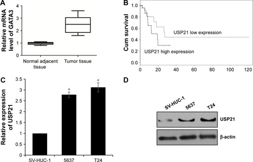 Figure 1 USP21 is highly expressed in BC tissues and cell lines, and it predicted poor prognosis of BC.