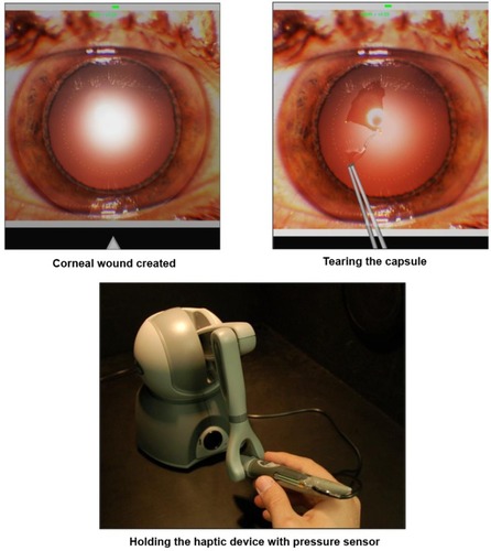 Figure 1 Capsulorhexis simulation.