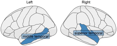 Figure 8. Two cortical thickness measures (one in the middle temporal region in the left hemisphere and the other in the superior temporal region in the right hemisphere) that were identified to have the mediated interaction effects on the relationship between amyloid beta accumulation and memory using XMInt on ADNI dataset.