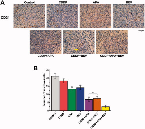 Figure 4. Combination therapy suppressed LLC tumour angiogenesis in vivo. (A) Representative images showing CD31 immunostaining in the tumour tissues of the differentially treated mice (original magnification, ×400). The yellow arrow indicates positively stained areas. (B) MVD in the pleural tumour nodules of the indicated groups. Data are expressed as mean ± SD. ** p <.01 vs CDDP + APA + BEV. APA: apatinib; BEV: bevacizumab; CDDP: cisplatin; CD31: cluster of differentiation 31; LLC: Lewis lung cancer; MVD: microvessel density; n.s.: not significant.