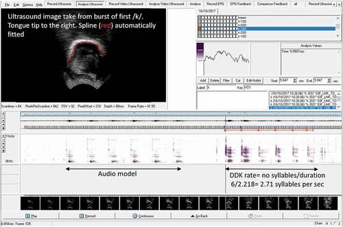 Figure 2. Screen shot of AAA software showing ultrasound image and spectrogram.