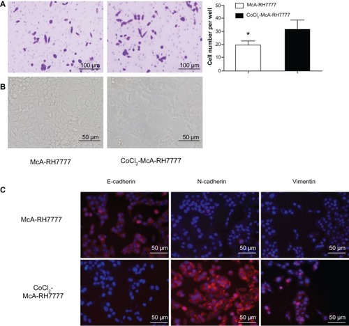 Figure 2 McA-RH7777 cells after CoCl2 treatment exhibited the properties of enhanced invasion and epithelial–mesenchymal transition.