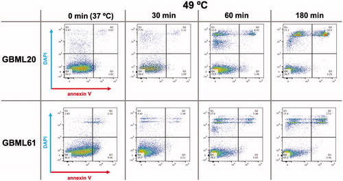 Figure 3. Heating GBM cells to 49 °C increases DAPI and annexin V staining. Representative flow cytometric analysis of GBML20 and GBML61 cells for DAPI and annexin V staining after heating to 49 °C for 30, 60 or 180 min.