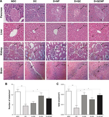 Figure 9 Photomicrographs of pancreas, liver, kidney, and brain sections after 35 days treatment with Fe3O4 NPs, QC, QC-Fe3O4 NPs (H&E staining, magnification 40×, scale bar: 30 µm) (A). The arrows show islets in pancreas, bile duct in liver, glomerular in kidney, and cell nuclear density and cytoplasm in hippocampus. The number of pancreatic islets/mmCitation2 (B) and the islet area (C) was measured from whole pancreas sections taken from rats. *P<0.05 and **P<0.01 vs diabetic control group (one-way ANOVA followed by Tukey’s test).Abbreviations: QC, quercetin; NP, nanoparticle; H&E, hematoxylin & eosin; NDC, non-diabetic control; DC, diabetic control; D+NP, diabetic treated with nanoparticle; D+QC, diabetic treated with quercetin; D+QCNP, diabetic treated with quercetin nanoparticle.