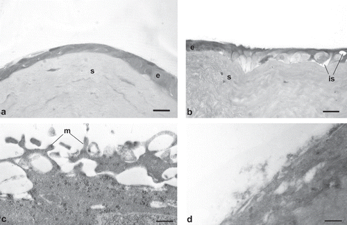 FIGURE 5  Photomicrographs of corneal epithelium structure at LM [(A) AG-Sol treated, and (B) control; scale bar = 10 µm] and at TEM [(C), AG-Sol treated, and (D) control; scale bar = 1 µm) 24 hr post wounding. Legend: e = epithelium; is = intercellular space; m = microvilli; s = stroma.