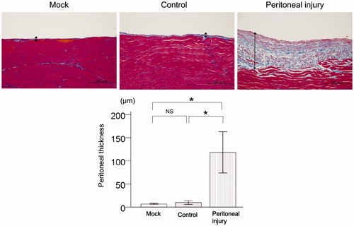 Figure 1. Histological changes in the peritoneum of rats with peritoneal injury. Representative Azan staining of the peritoneum with fibrous thickness indicated by arrows. Quantitative analysis of peritoneal thickness in mock rats (n = 6), control rats (n = 6), and rats with peritoneal injury (n = 6). Values are the mean ± standard error (error bars). Scale bar =100 μm. NS: not significant. *p < .05.