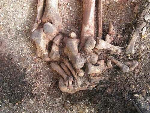 Figure 5. Tightly constricted foot bones of Zvejnieki 317