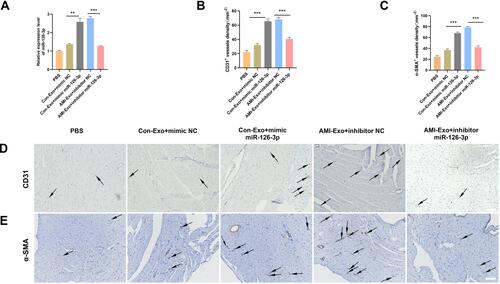 Figure 6 Effect of miR-126-3p in AMI-Exo and Con-Exo on angiogenesis after mouse acute myocardial infarction. (A) miR-126-3p expression in ischemic myocardium was measured using qRT-PCR after treatment for 24 h (n = 3). (B and C) Capillary density in ischemic myocardial was measured by the number of microvessels per mm2. (D and E) The CD31 and α-SMA expression was measured using immunohistochemistry. Scale bar, 200 μm. **p < 0.01, ***p < 0.001.