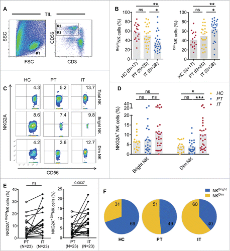 Figure 6. NKG2A expression is mainly increased in intratumor CD56dim NK cells from HCC patients. (A) The gating strategy for TIL used to analyze the CD56bright NK cells and CD56dim NK cells via flow cytometry. (B) The percentages of CD56bright NK cells and CD56dim NK cells from healthy livers (N = 17) and the IT (N = 28) and PT (N = 25) regions of HCC patients (Kruskal–Wallis ANOVA followed by Dunn's multiple comparisons test). (C) Representative NKG2A expression in different liver NK cell subsets from healthy controls (left) and intratumor (right) and PT from HCC patients (middle). (D) Cumulative data on the percentages of NKG2A+ CD56bright NK cells (left) and NKG2A+ CD56dim NK cells (right) from healthy livers (N = 17) and intratumor (N = 28) and PT (N = 25) from HCC patients (Kruskal–Wallis ANOVA followed by Dunn's multiple comparisons test). (E) The percentages of NKG2A+ CD56bright NK cells (left) and NKG2A+ CD56dim NK cells (right) in paired central tumor and PT from each HCC patient. (F) The proportion of NKG2A+ CD56bright NK cells (yellow) and NKG2A+ CD56dim NK cells (blue) among the total NKG2A+ NK cells from intratumor regions (right), PT (middle) and healthy livers (left).