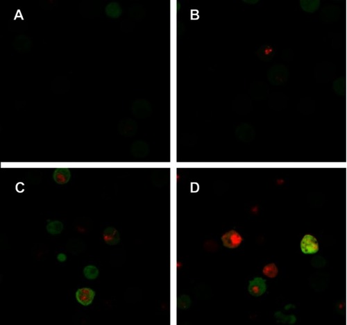 Figure 6 The autophagy induction of BEZ235 was observed under confocal microscopy (A panel is the control group, B panel is BEZ235 1 μM 12 h group, C panel is BEZ235 1 μM 24 h group, and D panel is BEZ235 5 μM 24 h group).