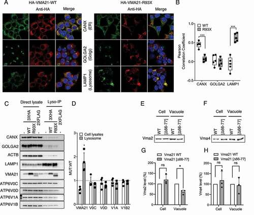 Figure 4. HA-VMA21 MUT 93X proteins aberrantly localized to lysosomes. (A) Confocal microscopy and merged images of cells stained for CANX (ER), GOLGA2 (Golgi) and LAMP1 (lysosomes) and HA-VMA21 WT or MUT. (B) Pearson correlation coefficients for colocalization of VMA21 WT or MUT proteins from (A). (C) Representative results for lysosomal-IPs (lyso-IPs; see Materials and Methods) out of stable HEK293T cells expressing the fusion protein bait 3xHA-TMEM192 or 2xFLAG-TMEM (negative control) and inducible VMA21 WT and MUT. Detection of protein in direct cell lysates and in the retained lysosomal IP preparations for the indicated antigens. (D) Densitometry quantification (VMA21 MUT:WT protein) of n = 3 independent experiments from representative panel C and quantification of V-ATPase components from either lysates or enriched lysosomes. Statistical comparisons using unpaired 2-tailed t-testing (*: p < 0.05). Bars: Standard deviations. (E-H) S. cerevisiae cells expressing either full-length Vma21 (WT) or the truncation mutant Vma21[∆66-77] were analyzed for assembly of V-ATPase subunits. (E) The cellular and vacuolar Vma2 protein levels were monitored: The cells were grown in YPD to mid-log phase, and vacuoles were isolated. The levels of Vma2 were analyzed by western blot. Ponceau S staining was used for total protein normalization. (F) The cellular and vacuolar Vma4 protein levels were monitored as in (E). (G) Vma2 and (H) Vma4 protein levels. Either cellular or vacuolar Vma2 and Vma4 protein levels in WT cells were set to 100%, and the corresponding levels in Vma21[∆66-77] cells were normalized. Mean ± SD of n = 3 independent experiments are shown. Unpaired, 2-tailed t-test; *: p < 0.05, ns: not significant.