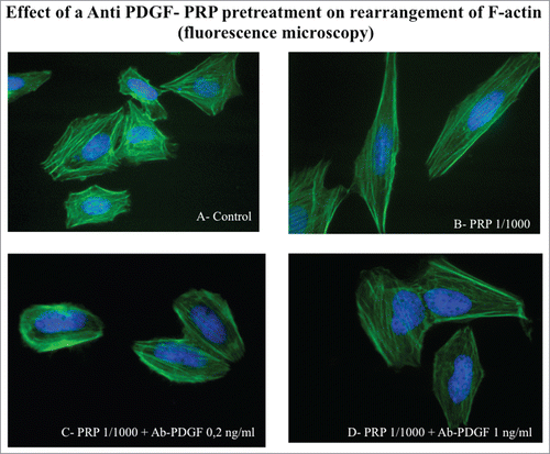 Figure 8. Effect of an Anti PDGF-PRP treatment on the rearrangement of actin microfilaments. Fluorescence images of phalloidin stained SaOS-2 cells treated with culture media (A), PRP 1/1000 for 60 minutes (B), PRP 1/1000 plus Ab PDGF 0.2 ng/ml (C) and PRP 1/1000 plus Ab PDGF 1 ng/ml and (D). Images in fluorescence microscopy at 63× magnification.