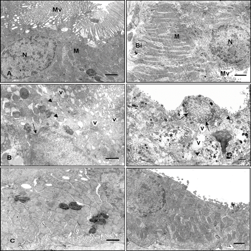 Figure 3. Electron micrographs of rat renal tubules. Left panel shows proximal renal tubules, right panel shows distal tubules. (A) Control rat. Left and right panels show normal morphology. (B) Cisplatin-treated rat. Left and right panels show numerous cytoplasmic vacuoles (v), invagination of the nuclear envelope (arrow), rounded mitochondria with disordered cristae (arrowhead), shortening and loss of basal infoldings, partial loss of cytoplasm (asterisk), and microvilli. (C) Cisplatin + vitamin C-treated rat. Left and right panels show little evidence of damaged cellular structure (uranyl acetate and lead citrate, scale bar: 1μm). Abbreviations: microvilli (Mv), nucleus (N), mitochondria (M), and basal infoldings (Bi).