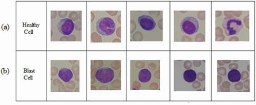 Figure 3. Typical microscopic images: (a) healthy cells and (b) blast cells.