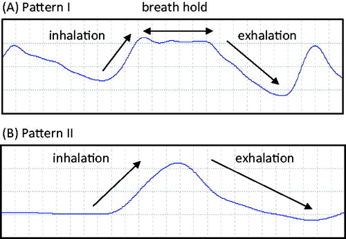 Figure 2. Respiratory patterns.