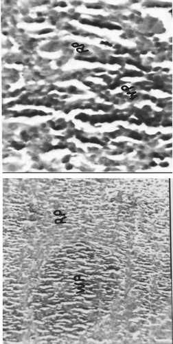 FIG. 2A Representative photomicrograph of splenic tissues recovered from rats on Day 22 of the respective indicated treatment regimens (WP = White pulp and RP = Red pulp)—Control rats. Left image at 10×, Right image at 40×.