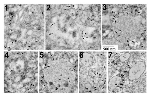 Figure 8. LC3B is detected by immunogold labeling in eggs treated with U0126 and roscovitine for 7 h. (Examples 1 to 7) of images obtained after observation under EM are shown. Immunogold particles (arrow) were always detected close to vesicular structures that were associated together (3, 5, 7) and often localized in the vicinity of ER (1). Some particles were clearly associated with membranes of these structures (stars).