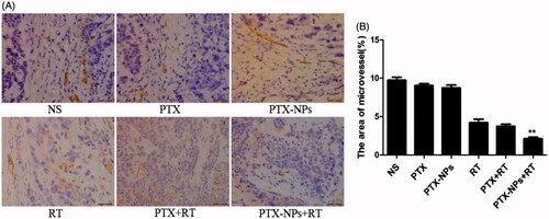 Figure 6. CD31 immunohistochemical staining of tumors. (A) CD31 immunohistochemical images of tumor tissue from mice in various groups. (B) CD31 quantitative analysis in xenografts from mice in various groups. *p < 0.05 and **p < 0.01. Original magnification, ×400.