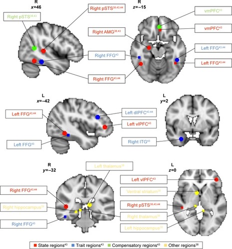 Figure 2 Brain regions demonstrating differences in activation during biological motion relative to scrambled motion.