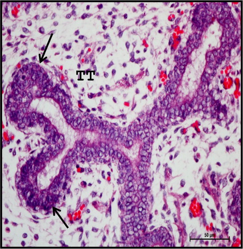 Figure 3. Photomicrograph of mandibular salivary gland of 13.2 cm CVRL (88th day) buffalo foetus showing two to three layered epithelium lining (arrows) of the TT with central lumen. Haematoxylin and Eosin method ×400.