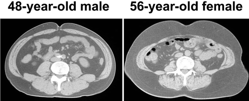 Figure 7. Representative CT scanning images of middle‐aged man and woman. In general, women have relatively larger amounts of subcutaneous fat in the abdomen compared to men.