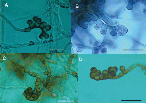 Figure 1. Developing conidiophores and conidia from four strains of Glarea lozoyensis. A. ATCC 20868=F-160870. B. F-226836. C. F-226838. D. F-239379. Scale bar = 20 μm.