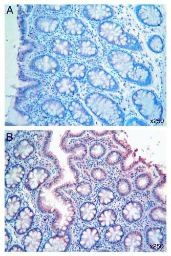 Figure 1. (A) A homogeneous and punctate immunostaining for Tβ4 is detected in the cytoplasm at the base and at apical cell regions of normal colon epithelium. Immunoreactive granular deposits are observed on the enterocyte surface and inside the intestinal lumen. (B) Tβ4 immunoreactive perinuclear spots are observed in the enterocytes of normal colonic mucosa adjacent to adenocarcinoma margins. OMx250.