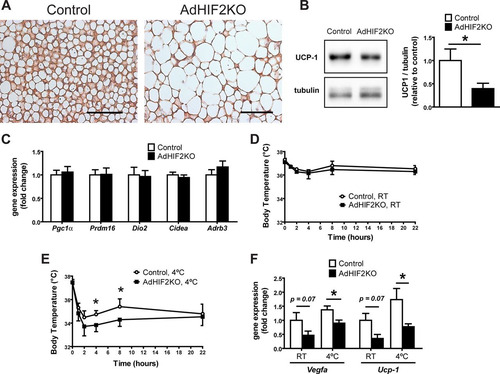 FIG 9 Reduced UCP1 expression in the BAT of obese adipocyte-specific HIF2α-deficient mice. (A) Representative images of UCP1 immunohistochemistry in BAT from control and AdHIF2KO mice fed for 24 weeks on an HFD diet. Scale bars are 100 μm. (B) Representative Western blot for UCP1 and tubulin (left) and quantification (right) from BAT protein lysates from control and AdHIF2KO mice after being fed an HFD for 24 weeks. The UCP1/tubulin ratio of control mice was set as 1 (n = 4 or 5/group). (C) Gene expression of Pgc1α, Prdm16, Dio2, Cidea, and Adrb3 in BAT from control and AdHIF2KO mice fed an HFD for 24 weeks. Gene expression of control mice was set as 1 (n = 7 to 14/group). (D and E) Obese control and AdHIF2KO mice were exposed to either room temperature (RT) (D) or 4°C (E), and temperature was measured (n = 3 or 4 for RT and n = 9 to 12 for 4°C). (F) Gene expression analysis of the BAT from the mice whose results are displayed in panels D and E. Gene expression of control RT mice was set as 1. Data in panels B to F are expressed as means ± SEMs. *, P < 0.05.