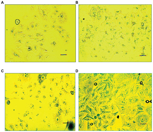 Figure S6 HeLa cells stained with Prussian blue: (A) control; (B) 3-aminopropylsilane-coated magnetic iron oxide nanoparticles (MIONPs); (C) polyethylene glycol hydrogel-coated MIONP-60; (D) arginine-glycine-aspartic acid-serine-functionalized polyethylene glycol hydrogel-coated MIONP-60 (scale bar: 25 μM).Note: Number in abbreviation MIONP-60 indicates corresponding illumination time in seconds.