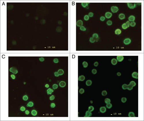 Figure 1. Immunofluorescence microscopy of doxycycline induced CXCR4 surface protein expression in stable transfected K-562 cells. (A) Control untransfected K-562 cells, (B) Wild type CXCR4 stable transfected K-562 cells, (C) N119ACXCR4-pTRE2hyg stable transfected K-562 cells, (D) N119SCXCR4-pTRE2hyg stable transfected K-562 cells.