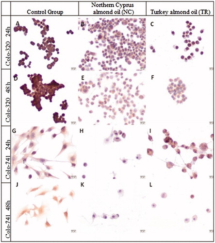 Figure 6. Immunoreactivity of Jagged 1 in Colo-320 (A–F) and Colo-741 cells (G–L) for 24 (A–C, G–I) or 48 h (D–F, J–L) culture with standard culture conditions (A, D, G, J) or Northern Cyprus (B, E, H, K) or Turkey (C, F, I, L) almond oils. Scale Bars = 20 μm.