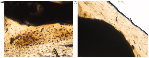 Figure 9. Photomicrograph (100×) ground section of: (a) 3% gel group showing well organized mature bone with no gap and (b) control group showing immature bone.