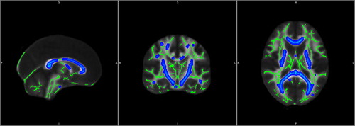 Figure 3. WM structural differences from the 6- to the 8-month AaP treatment time point. Green pseudocolor represents normal WM and blue pseudocolor represents sites of WM impairment.