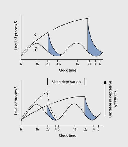 Figure 2 Two-process mode! of sleep deprivation (SD) and depression . This model can explain the antidepressant effect of SD by assuming that an insufficient build-up of process S (S stands for sleep need), SD transiently increases the level of process S, thus, leading to the antidepressant effect. Recovery sleep decreases process S to baseline levels leading to relapse into the depressed state. This model fits well with clinical observations that depressed patients have hyperarousal, which has been shown to be a positive predictor of the SD response.Citation4 Reproduced from reference 33: Borbély AA, Wirz-Justice A. Sleep, sleep deprivation and depression. Hum Neurobiol. 1982;1:205-210. Copyright © 1982, Springer Verlag.