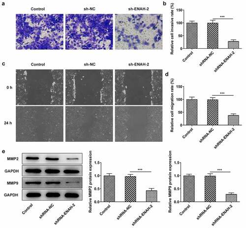 Figure 3. ENAH deficiency alleviates cell invasion and migration in HCC cells. (a-b) Transwell assay was to evaluate the invasive ability of SNU-387 cells. (c-d) Wound healing assay was to estimate cell migration in HCC. (e) MMP2 and MMP9 expression were examined by Western blot analysis. ***P < 0.001. ENAH, Enabled homolog. MMP2, matrix metallopeptidase 2. MMP9, matrix metallopeptidase 9.