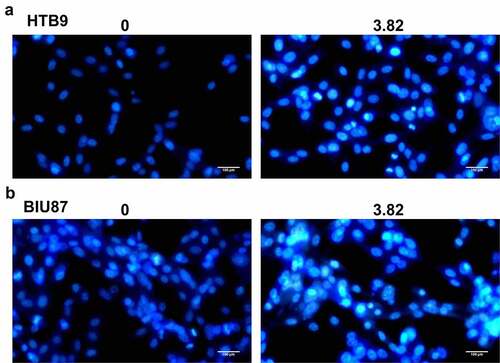 Figure 3. Effect of MI on the morphological changes in bladder cancer cells was observed by Hoechst 33,258 staining assay. (a) the morphological changes in bladder cancer HTB9 cells were observed by Hoechst 33,258 staining assay; (b) the morphological changes in bladder cancer BIU87 cells were observed by Hoechst 33,258 staining assay. Magnification, × 400. Scale bar = 50 μm.